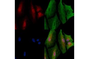 ABIN6265263 and ABIN6272950 staining  cells by IF/ICC.