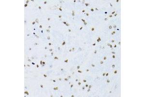 Immunohistochemistry of paraffin-embedded rat brain using NFKB2 Antibody.