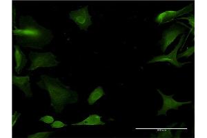 Immunofluorescence of monoclonal antibody to CYP1A2 on HeLa cell. (CYP1A2 anticorps  (AA 211-310))