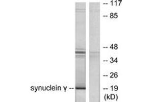 Western blot analysis of extracts from HT29 cells, using Synuclein gamma Antibody. (SNCG anticorps  (AA 78-127))