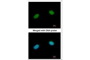 ICC/IF Image Immunofluorescence analysis of paraformaldehyde-fixed HeLa, using XRCC3, antibody at 1:200 dilution.