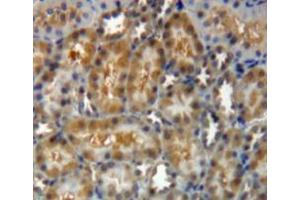 Used in DAB staining on fromalin fixed paraffin-embedded kidney tissue (Gelsolin anticorps  (AA 432-780))