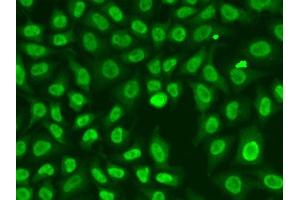 Immunofluorescence analysis of A549 cells using CHEK2 antibody.
