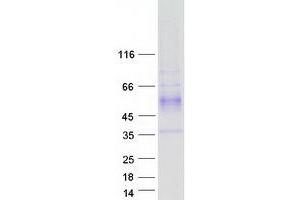 Validation with Western Blot