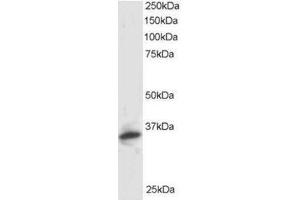 Image no. 1 for anti-Proteasome (Prosome, Macropain) Inhibitor Subunit 1 (PI31) (PSMF1) (C-Term), (Isoform 1) antibody (ABIN374303) (PSMF1 anticorps  (C-Term, Isoform 1))