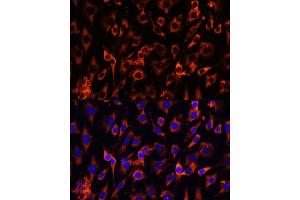 Immunofluorescence analysis of C6 cells using MCTS1 antibody (ABIN6132341, ABIN6143657, ABIN6143658 and ABIN6224877) at dilution of 1:100 (40x lens).
