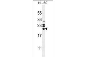 CSF2 Antibody (Center) (ABIN654647 and ABIN2844343) western blot analysis in HL60 cell line lysates (35 μg/lane). (GM-CSF anticorps  (AA 59-85))