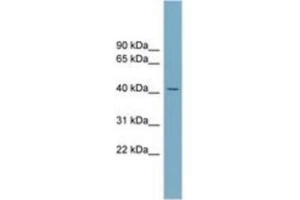 SLC30A8 anticorps  (AA 107-156)
