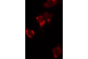 ABIN6272351 staining HuvEc by IF/ICC. (MRPL48 anticorps  (Internal Region))