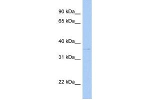 WB Suggested Anti-SULT1C2 Antibody Titration:  0. (SULT1C2 anticorps  (C-Term))