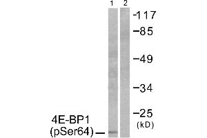 Western blot analysis of extracts from Jurkat cells, treated with Insulin (0. (eIF4EBP1 anticorps  (pSer64))