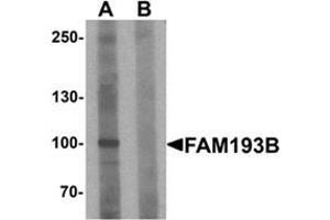 Western blot analysis of FAM193B in Jurkat cell lysate with FAM193B Antibody  at 1 ug/ml in (A) the absence and (B) the presence of blocking peptide. (FAM193B anticorps  (N-Term))