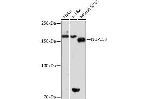 Western blot analysis of extracts of various cell lines, using NUP153 Rabbit mAb (ABIN1512527, ABIN3023298, ABIN3023299 and ABIN7101477) at 1:1000 dilution. (NUP153 anticorps)