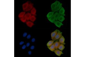 ABIN6256850 and ABIN6273556 staining Hela cells(45 min of heat-shock treatment) by IF/ICC. (ERC1 anticorps  (N-Term))