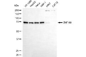 Western blotting analysis using ZNF160 antibody (ABIN7800893).