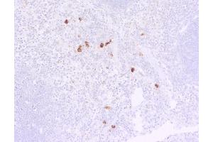 Indirect immunostaining of PFA fixed, paraffin embedded mouse spleen section (dilution 1 : 50, 1h incubation). (Rat anti-Souris IgG lambda (Light Chain) Anticorps)