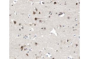ABIN6268831 at 1/200 staining human brain tissue sections by IHC-P.