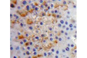 IHC-P analysis of liver tissue, with DAB staining. (IL17RC anticorps  (AA 257-477))