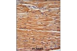 GIT1 Antibody (Center) (ABIN6243000 and ABIN6578993) immunohistochemistry analysis in formalin fixed and paraffin embedded mouse heart tissue followed by peroxidase conjugation of the secondary antibody and DAB staining.
