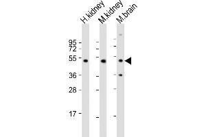 All lanes : Anti-NDUFV1 Antibody (N-term) at 1:2000 dilution Lane 1: human kidney lysate Lane 2: mouse kidney lysate Lane 3: mouse brain lysate Lysates/proteins at 20 μg per lane.