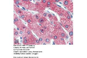Immunohistochemistry with Human Liver cell lysate tissue at an antibody concentration of 5. (ZNF777 anticorps  (Middle Region))