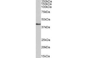 ABIN4902659 (0. (HMBS anticorps)