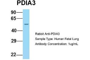 Host: Rabbit  Target Name: PDIA3  Sample Tissue: Human Fetal Lung  Antibody Dilution: 1. (PDIA3 anticorps  (C-Term))