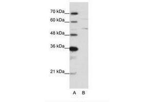 Image no. 2 for anti-Heterogeneous Nuclear Ribonucleoprotein K (HNRNPK) (N-Term) antibody (ABIN6736200) (HNRNPK anticorps  (N-Term))