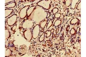 Immunohistochemistry of paraffin-embedded human thyroid tissue using ABIN7174723 at dilution of 1:100 (C12orf43 anticorps  (AA 1-263))