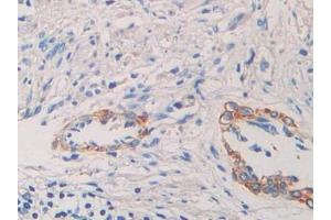 Used in DAB staining on fromalin fixed paraffin- embedded kidney tissue