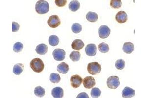 Immunocytochemistry of ILP-2 in HepG2 cells with AP30430PU-N ILP-2 antibody at 10 μg/ml.