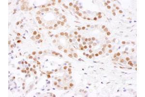 Immunohistochemistry (IHC) image for anti-Splicing Factor 3b, Subunit 4, 49kDa (SF3B4) (AA 374-424) antibody (ABIN7454988)