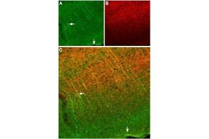 Expression of SSTR2 in mouse cortex - Immunohistochemical staining of frozen mouse cortex sections using Anti-Somatostatin Receptor Type 2 (extracellular) Antibody (ABIN7043765, ABIN7045268 and ABIN7045269), (1:100).