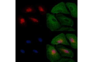 ABIN6263548 and ABIN6277572 staining  cells by IF/ICC.
