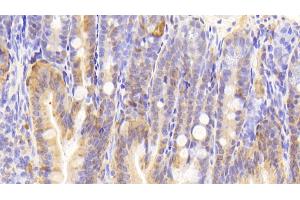 Detection of GAL2 in Mouse Colon Tissue using Polyclonal Antibody to Galectin 2 (GAL2) (Gallinacin-2 (GAL2) (AA 1-130) anticorps)