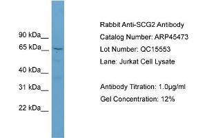 WB Suggested Anti-SCG2  Antibody Titration: 0. (SCG2 anticorps  (N-Term))