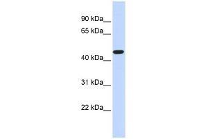 ACOT2 antibody used at 1 ug/ml to detect target protein. (ACOT2 anticorps  (Middle Region))