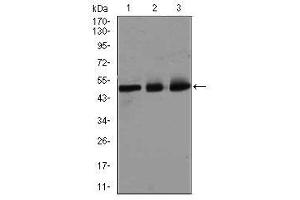Image no. 5 for anti-E2F Transcription Factor 1 (E2F1) antibody (ABIN1491636) (E2F1 anticorps)