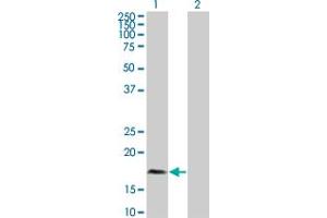 Western Blot analysis of PLA2G12A expression in transfected 293T cell line by PLA2G12A polyclonal antibody (A01). (PLA2G12A anticorps  (AA 90-188))
