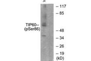 Western blot analysis of extracts from Jurkat cells, using TIP60 (Phospho-Ser86) Antibody. (KAT5 anticorps  (pSer86))