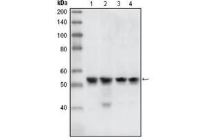 Western Blotting (WB) image for anti-Checkpoint Kinase 1 (CHEK1) antibody (ABIN1106682) (CHEK1 anticorps)