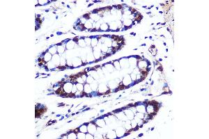 Immunohistochemistry of paraffin-embedded human colon using APIP Rabbit pAb (ABIN6131310, ABIN6136985, ABIN6136986 and ABIN6222909) at dilution of 1:100 (40x lens). (APIP anticorps  (AA 1-242))