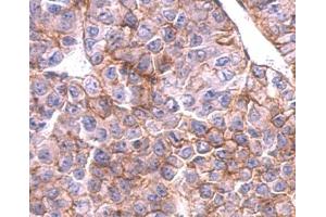 IHC-P Image SLC20A1 antibody [N3C2], Internal detects SLC20A1 protein at cytosol and membrane on AGS xenograft by immunohistochemical analysis.
