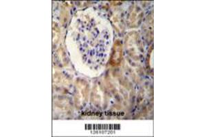 NR3C1 Antibody immunohistochemistry analysis in formalin fixed and paraffin embedded human kidney tissue followed by peroxidase conjugation of the secondary antibody and DAB staining. (Glucocorticoid Receptor anticorps  (C-Term))