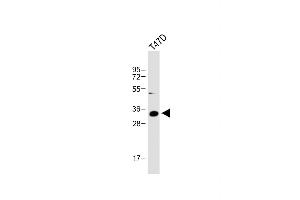 Anti-IGFBP2 Antibody (C-term) at 1:1000 dilution + T47D whole cell lysate Lysates/proteins at 20 μg per lane. (IGFBP2 anticorps  (C-Term))