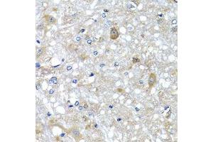 Immunohistochemistry of paraffin-embedded rat brain using ETFA antibody. (ETFA anticorps  (AA 1-333))