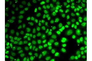 Immunofluorescence analysis of MCF7 cells using XPO5 antibody. (XPO5 anticorps  (AA 925-1204))