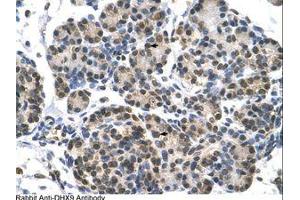 Image no. 1 for anti-ATP-Dependent RNA Helicase A (DHX9) (AA 171-220) antibody (ABIN6736602)