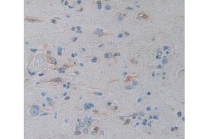 IHC-P analysis of Kidney tissue, with DAB staining. (ICAM-3/CD50 anticorps  (AA 46-197))