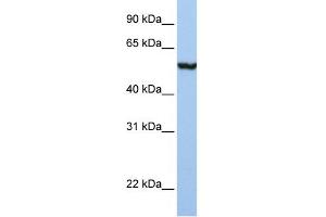 WB Suggested Anti-SLC39A5 Antibody Titration:  1 ug/ml  Positive Control:  Placenta (SLC39A5 anticorps  (N-Term))